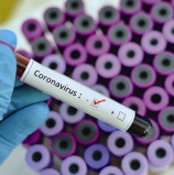 Santana de Parnaíba intensifica ações de combate ao Coronavírus